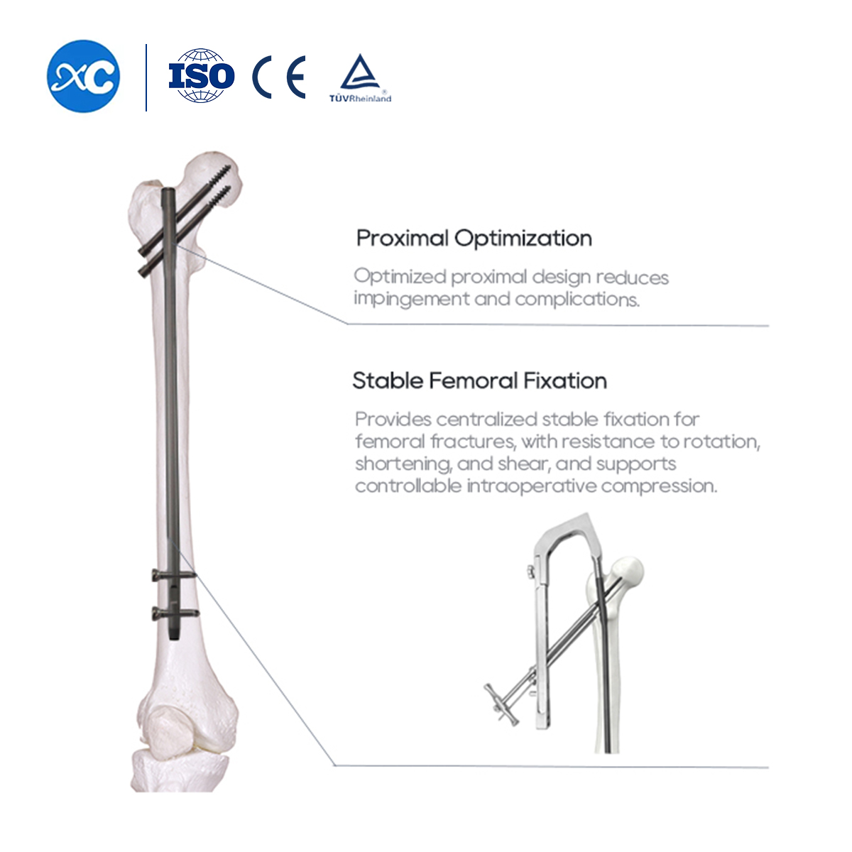 New Femoral Reconstruction Nail Instrument Set | Trauma Fixation