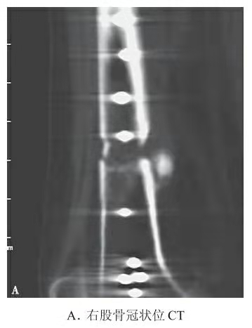 Representative X-ray of femoral fracture with plate fixation and partial callus formation