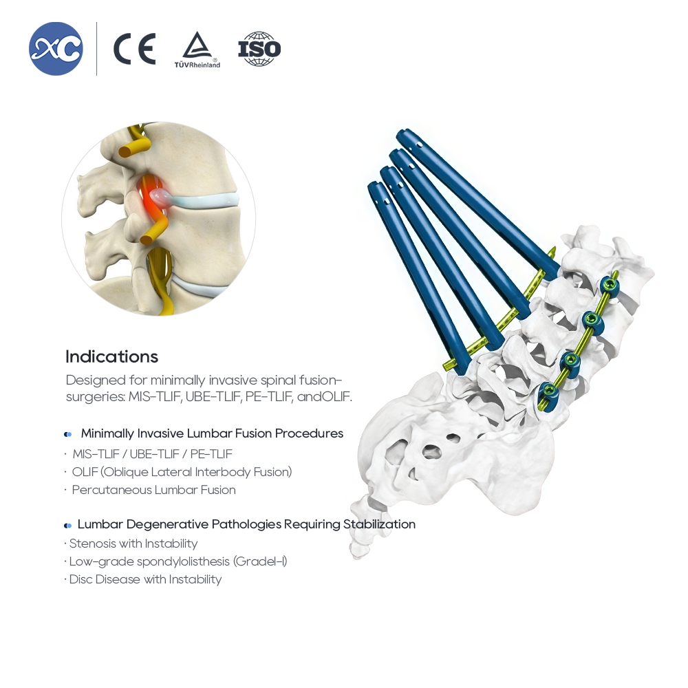 5.5 MIS Spinal System II Instrument Set | XC Medico