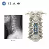 0.8mm Ultra-Thin Anterior Cervical Plate | Cervical Fixation System - 5