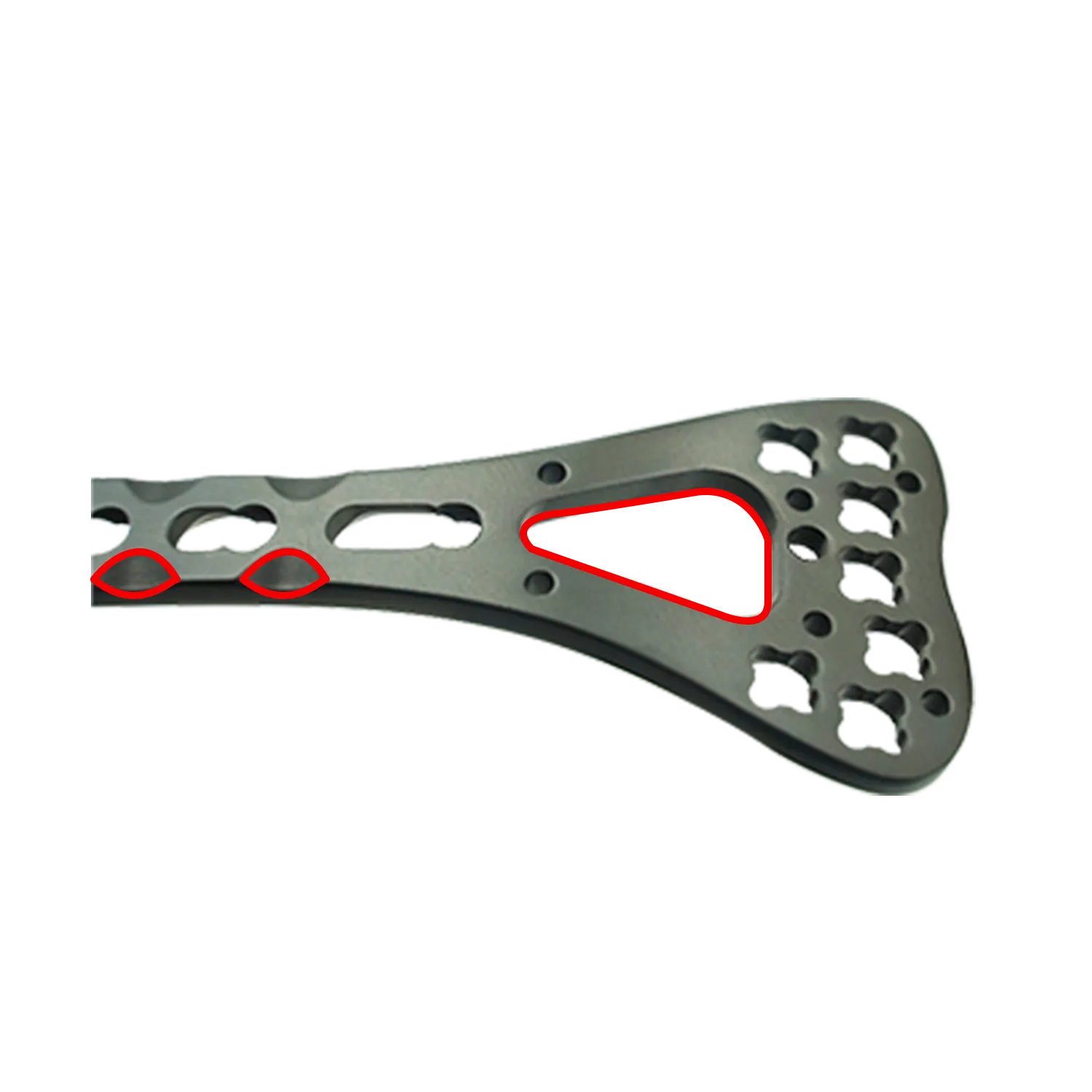 Contouring flexibility of the distal radius plate head for surgical adaptability