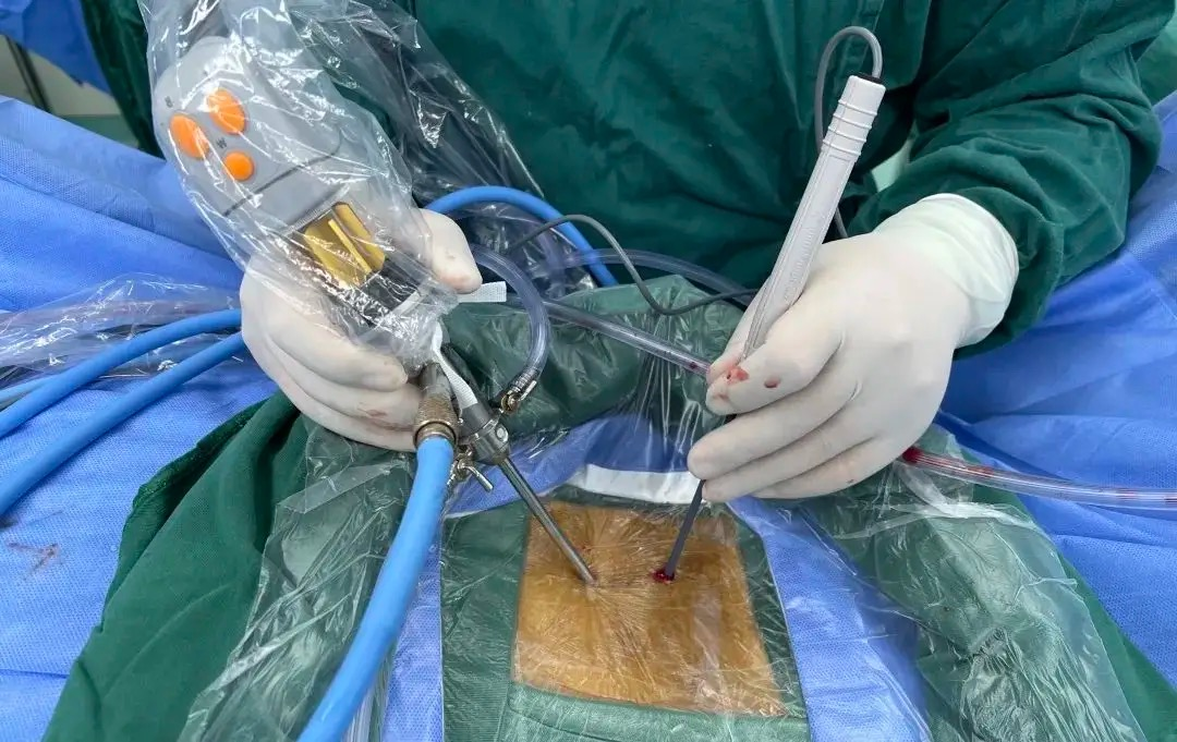 Orthopedic OR team reviewing a spinal implant tray and instruments before surgery