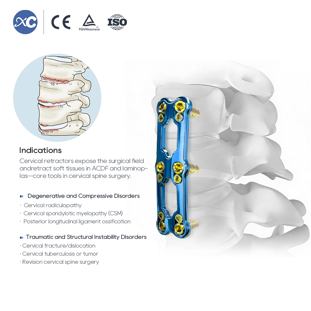 Ensemble ya ba instruments ya Retracteur ya cervix | Lipaso ya ACDF | XC Medico ya monganga