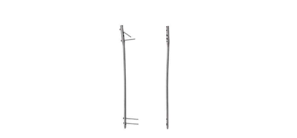 Femoral Reconstruction Nail Indications and Coverage