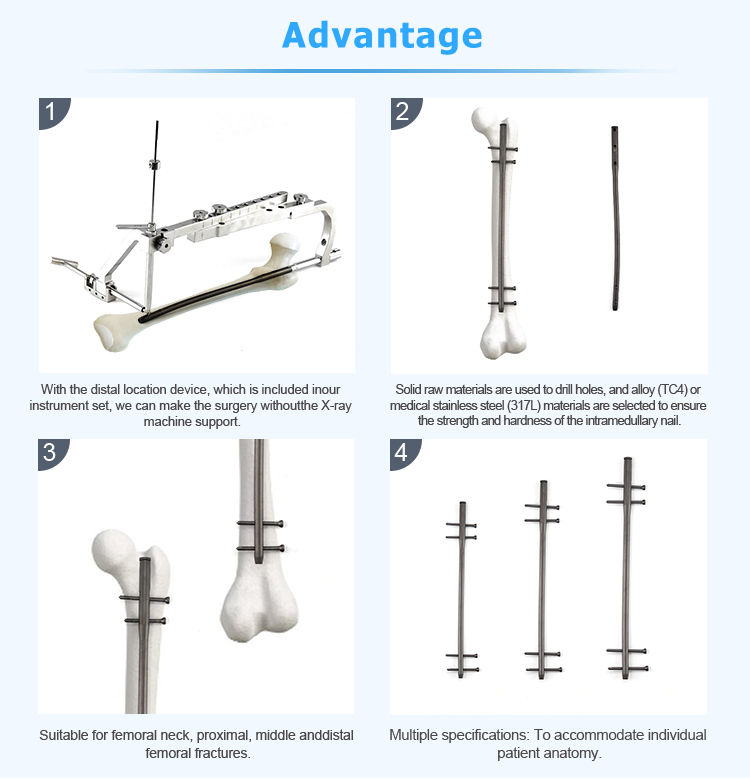 Advantages: Distal targeting without X-ray, Solid raw materials