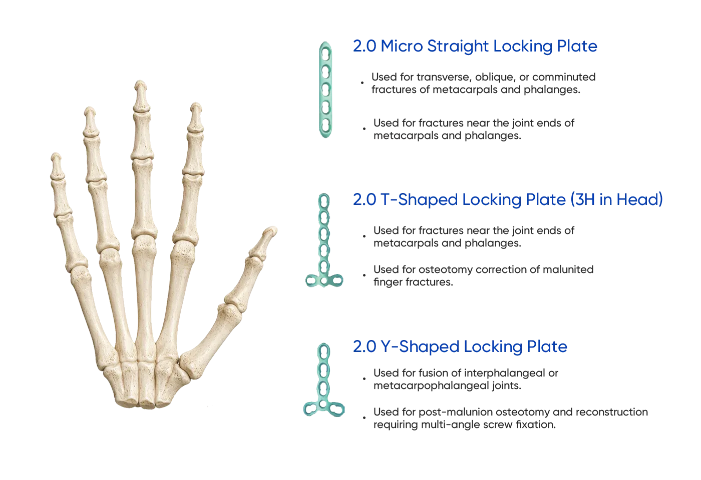 Separate metacarpal and phalangeal planning views