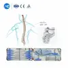 ALIF Anterior Interbody Cage Instrument Set | XC Medico - 3