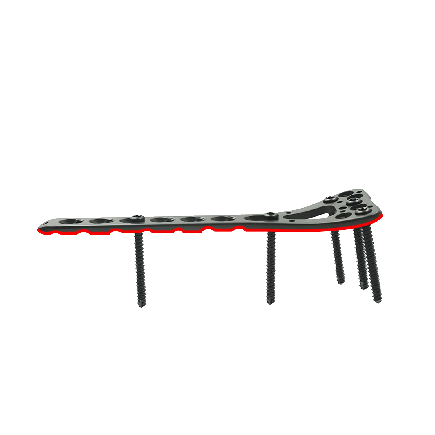Low-profile volar plate design reducing soft tissue irritation