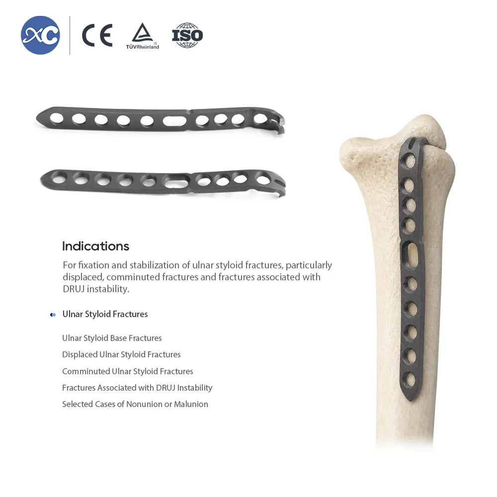 Ulnar styloid locking plate fixed on distal ulna bone model