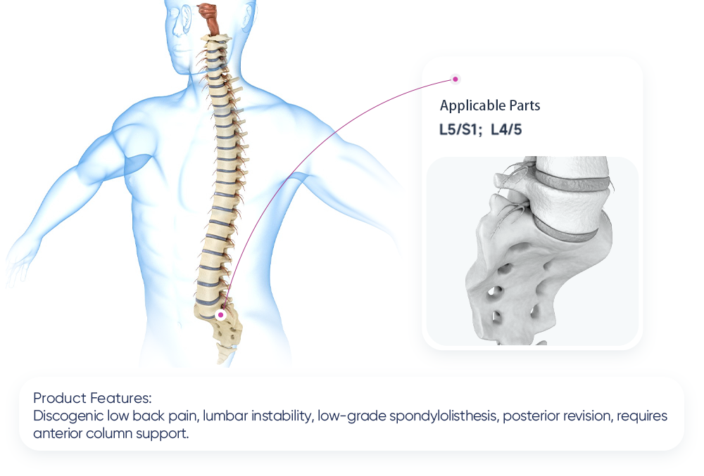 ALIF Cage System | Anterior Lumbar Interbody Fusion Implant | XC Medico
