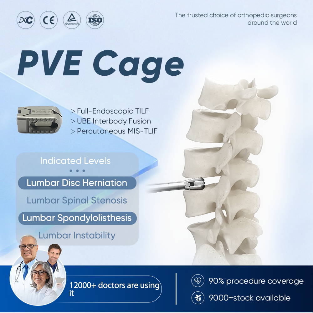 Expandable PVE Cage | MIS-TLIF & UBE Lumbar Fusion Implant