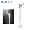 Intertan Nail System | xc medico