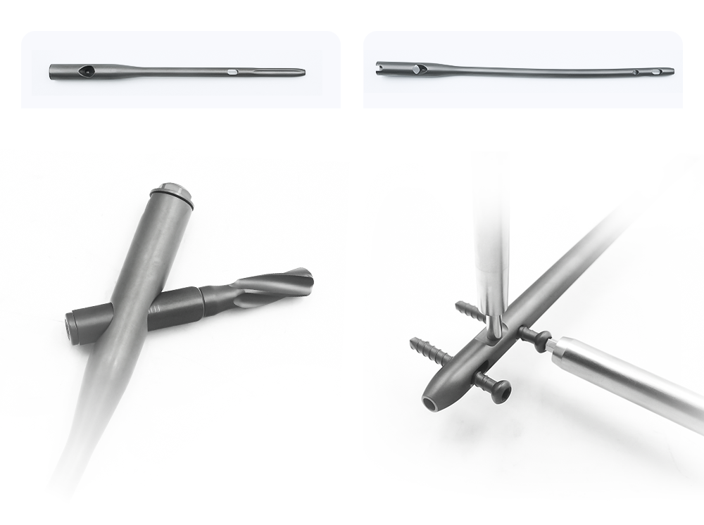 Indications for Short and Long Intramedullary Nails, TC20 Titanium CNC Machining