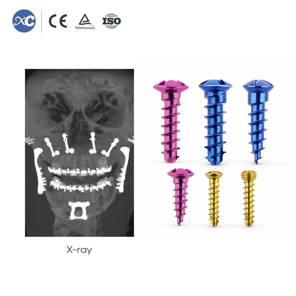 Maxillofacial Screw Manufacturer Titanium Fixation Screws for Facial Trauma - 3