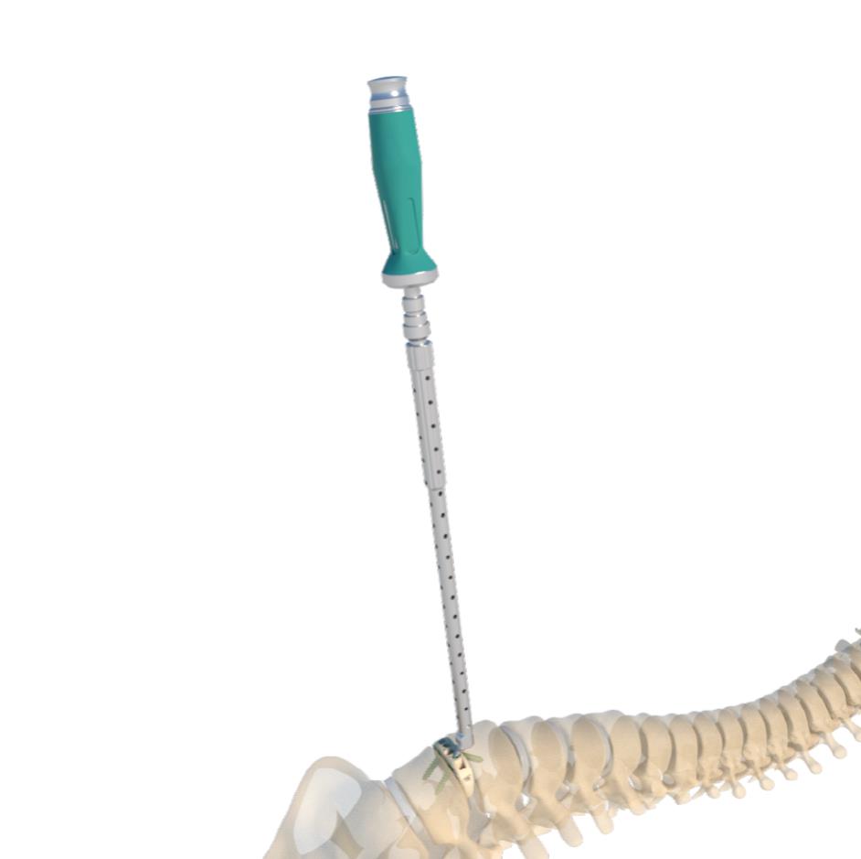 ALIF final screwdriver and handle