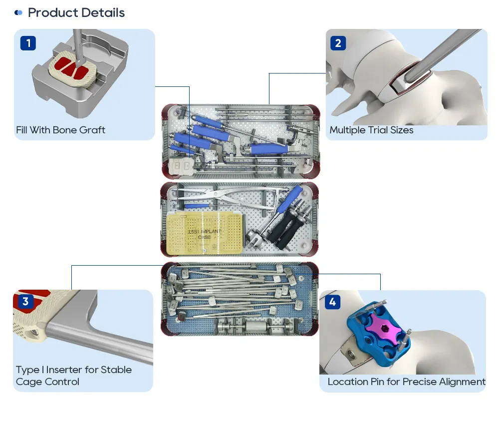 Bone Graft Filling + Trial Sizing