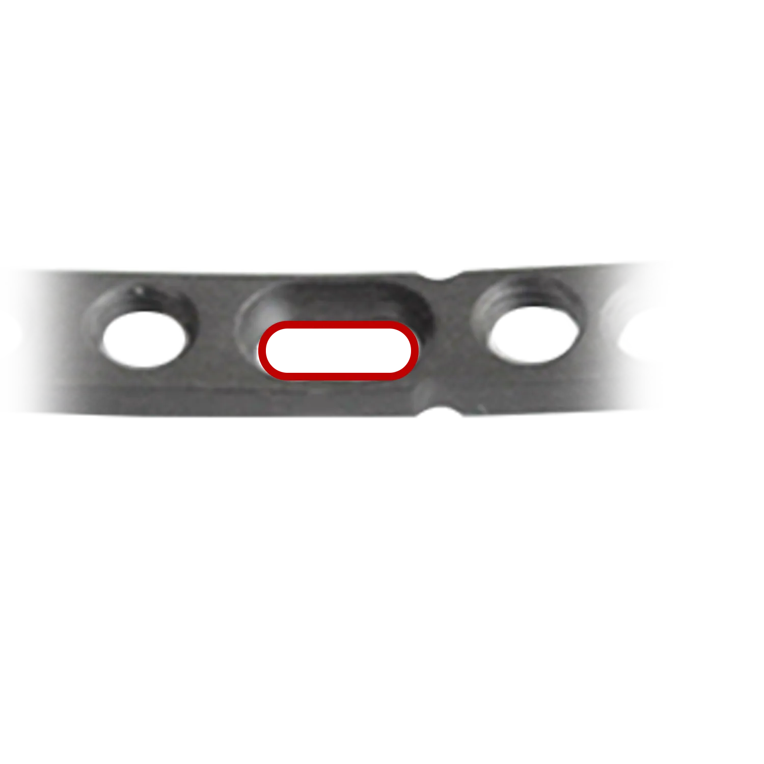 Compression slot on the ulnar styloid locking plate for reliable fixation