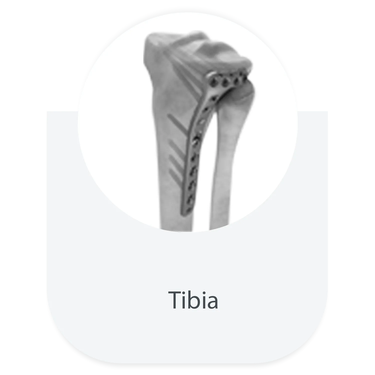 Tibia locking plate