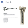 Distal Radius Locking Plate (7 Holes) - XC Medico - 2
