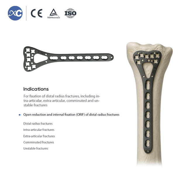 L&aring;seplate med distal radius (7 hull) - XC Medico - 2