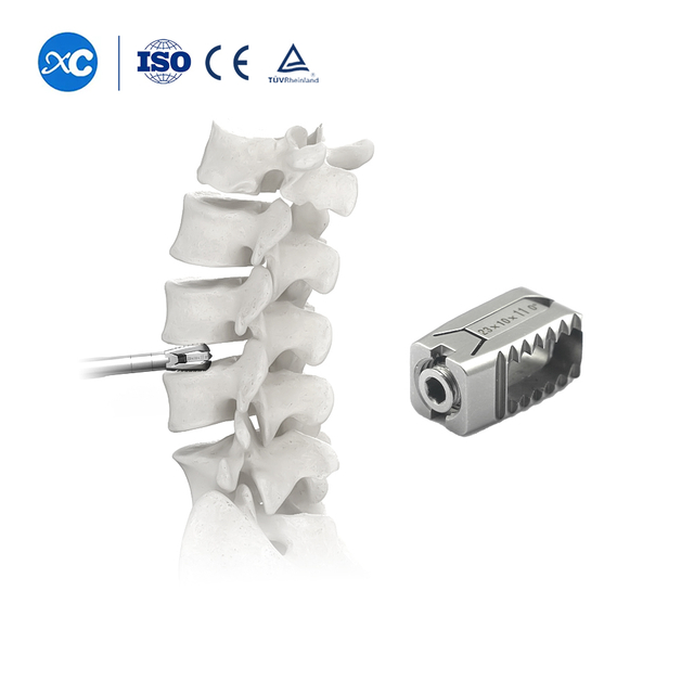 Napapalawak na PVE Cage | MIS-TLIF at UBE Lumbar Fusion Implant