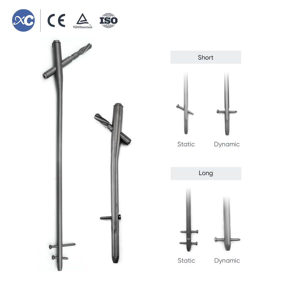 PFNA интрамедуларен пирон | Фиксиране на фрактура на проксимална бедрена кост