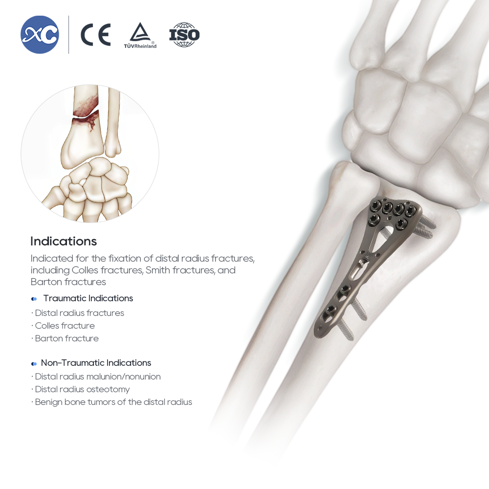 Distal Radius Instrument Set - XC Medico