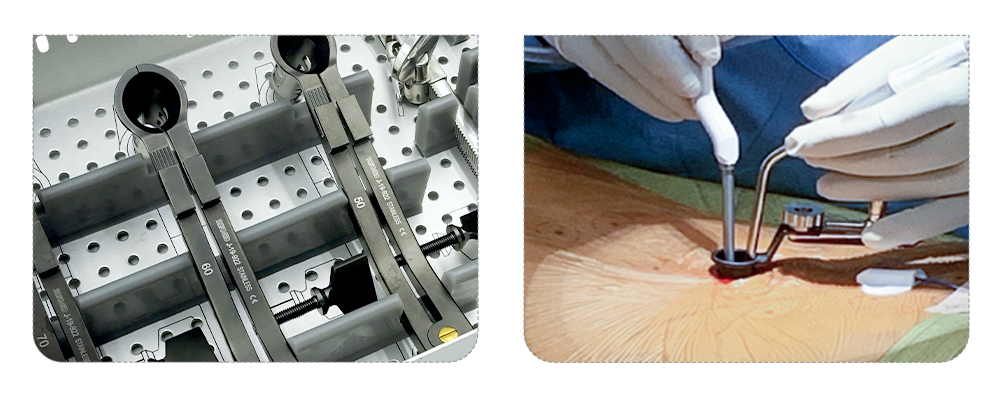 High-Precision CNC Machined Titanium Alloy Retractor Blades okulongoosa omugongo mu ngeri etali ya maanyi nnyo