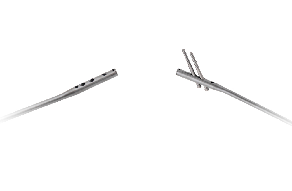 TC4 Titanium Alloy Femoral Implant Machining
