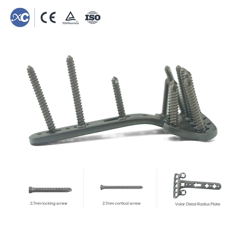 Distal Radius Volar Multi-axial Locking Plate | Titanium Orthopedic Implants & Fracture Fixation