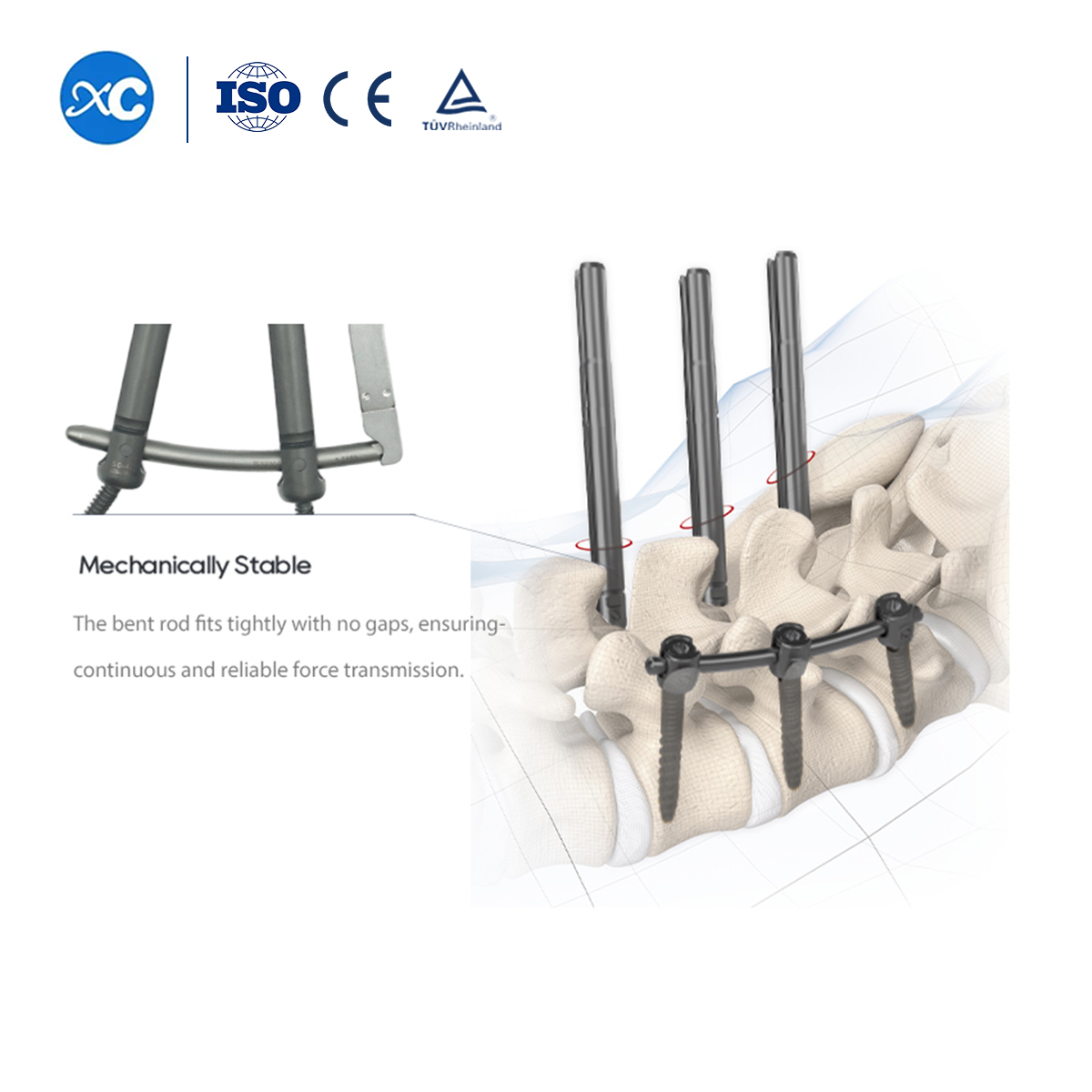 5.5 MIS Spinal System II | Pedicle Screw | XC Medico