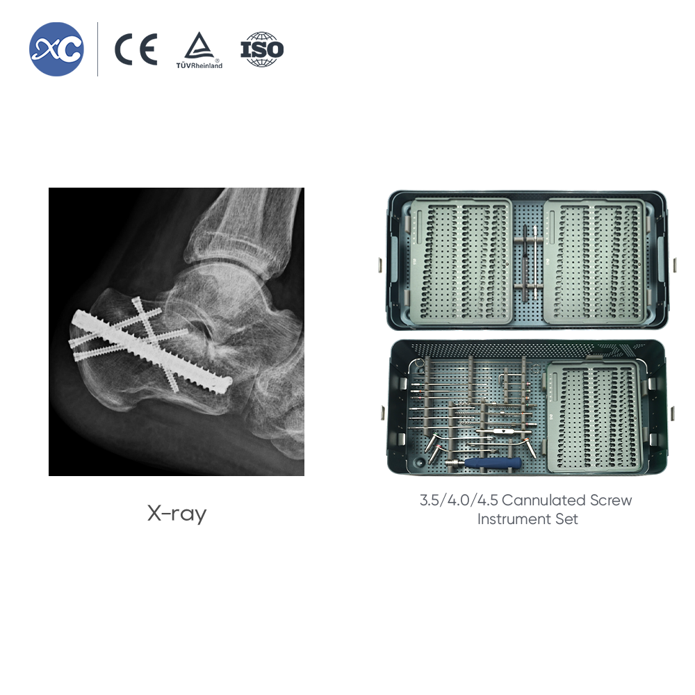 Cannulated Screw Instrument Set 3.5/4.0/4.5 | Trauma | XC Medico
