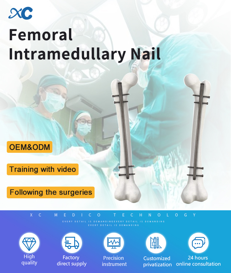 Femoral Intramedullary Nail System Overview
