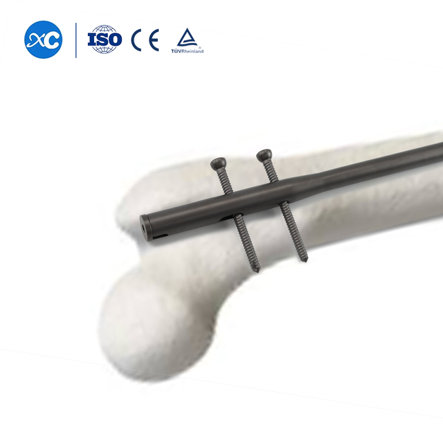 Clau intramedul&middot;lar femoral | Fixaci&oacute; del f&egrave;mur | XC Medic