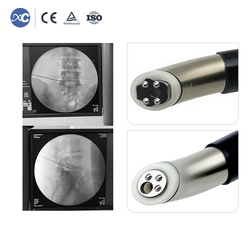 Plasma Radiofrequency Ablation System | Spine Endoscopy | XC Medico