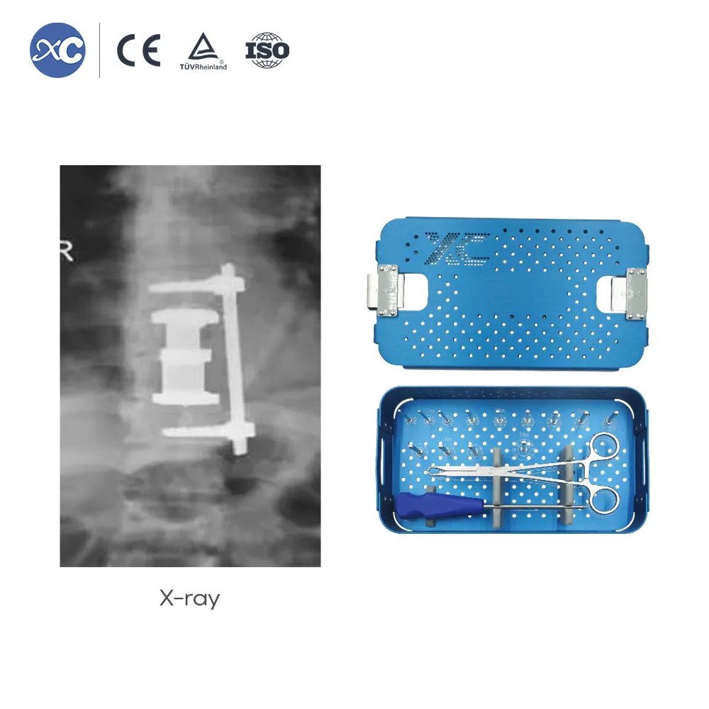 Expandable Titanium Cage Instrument Set | Spine Reconstruction Tools - 5