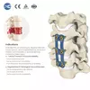 0.8mm Ultra-Thin Anterior Cervical Plate | Cervical Fixation System - 2