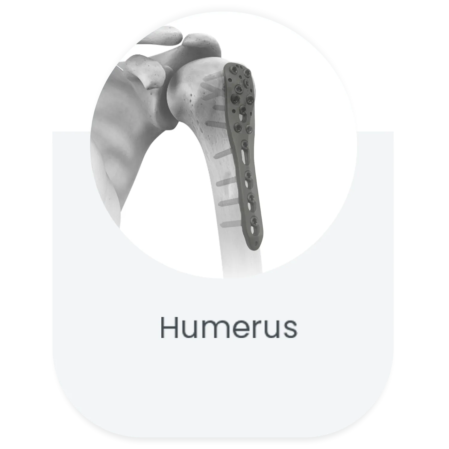 Proximal humerus locking plate