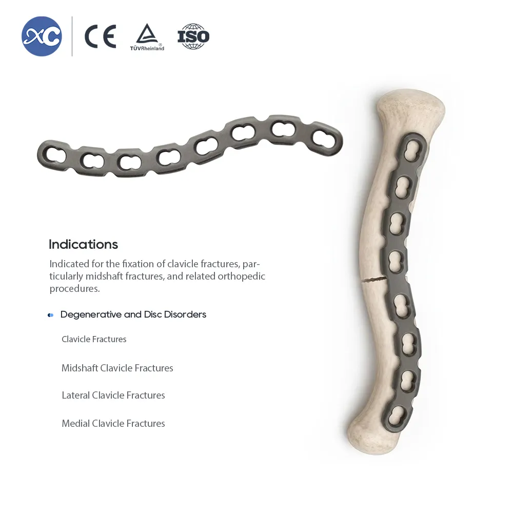 S-clavicle locking plate fixed on clavicle bone model for midshaft fracture