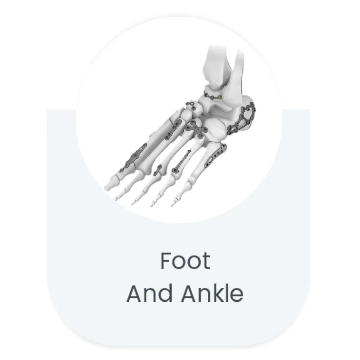 Foot and ankle locking plate system