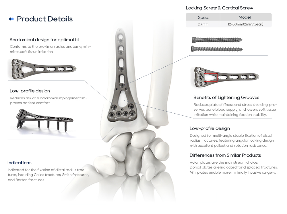 Anatomical Low-Profile Design and Lightening Grooves of Distal Radius Volar Locking Plate