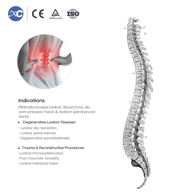 MLD артикулярлы ретрактор жинағы | Микро белдік дискэктомия құралдары