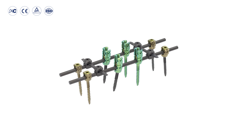 5.5mm Spinal Pedicle Screw System Thoracolumbar Implants