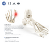 Headless Compression Screw Set 3.0/3.5/4.0 | XC Medico