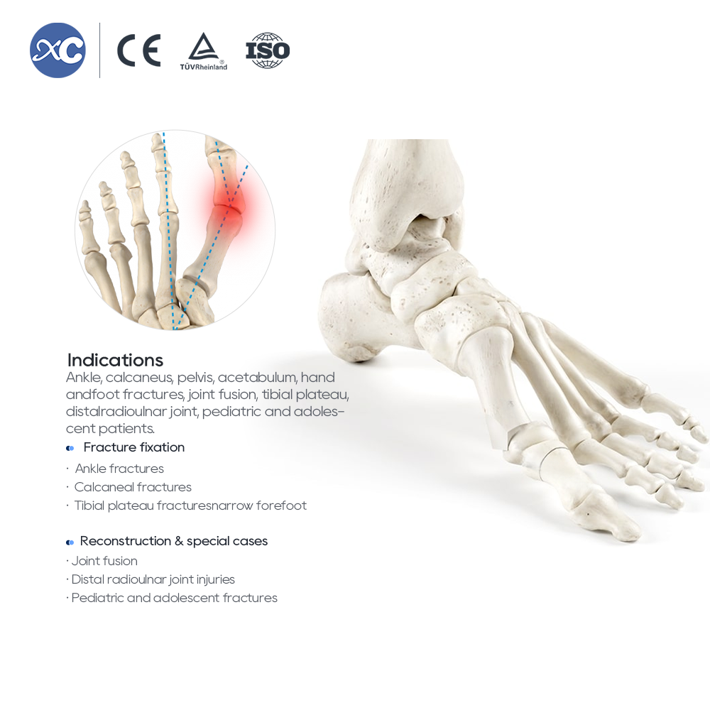 Headless Compression Screw Set 3.0/3.5/4.0 | XC Medico