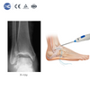 Disposable Arthroscope | Sports Medicine & Spine | XC Medico
