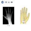 Disposable Wrist Arthroscopy Instrument Set