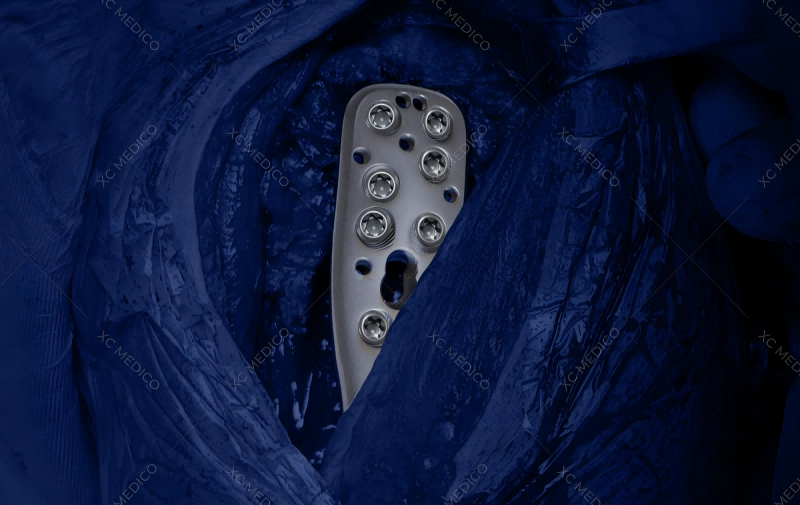 Siasino ti legal a managaramid ken nangimarka iti rekord kadagitoy a trauma device?