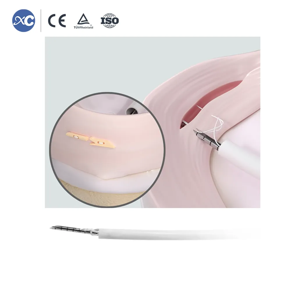 All-inside meniscus repair with two PEEK locking loops