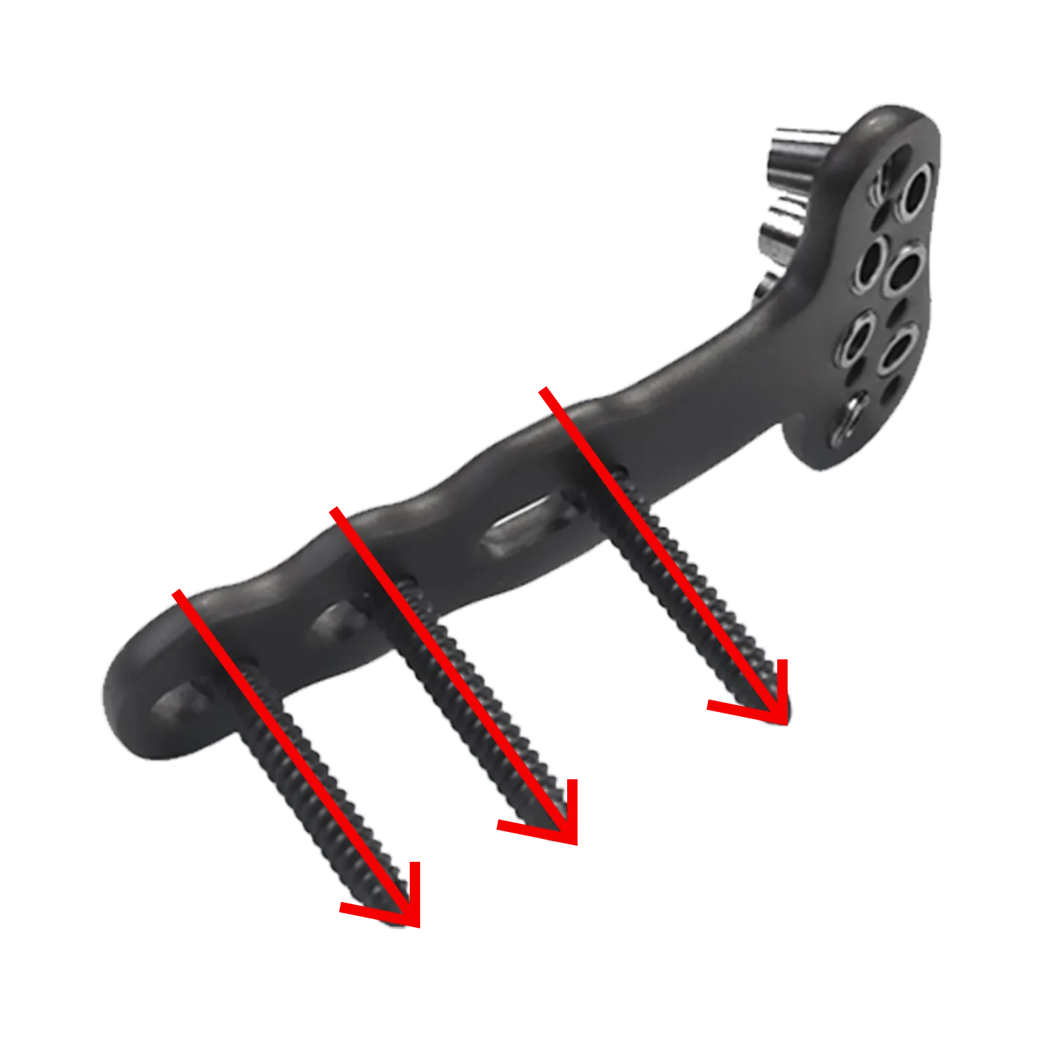 Compression and locking combination holes with screw trajectories on DVR plate shaft